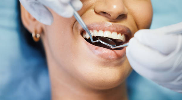 Best Broken or Chipped Tooth Repair in Mcgregor, TX