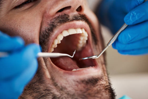 Best Emergency Treatment for Oral Infections in Mcgregor, TX